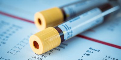 Allergy Testing