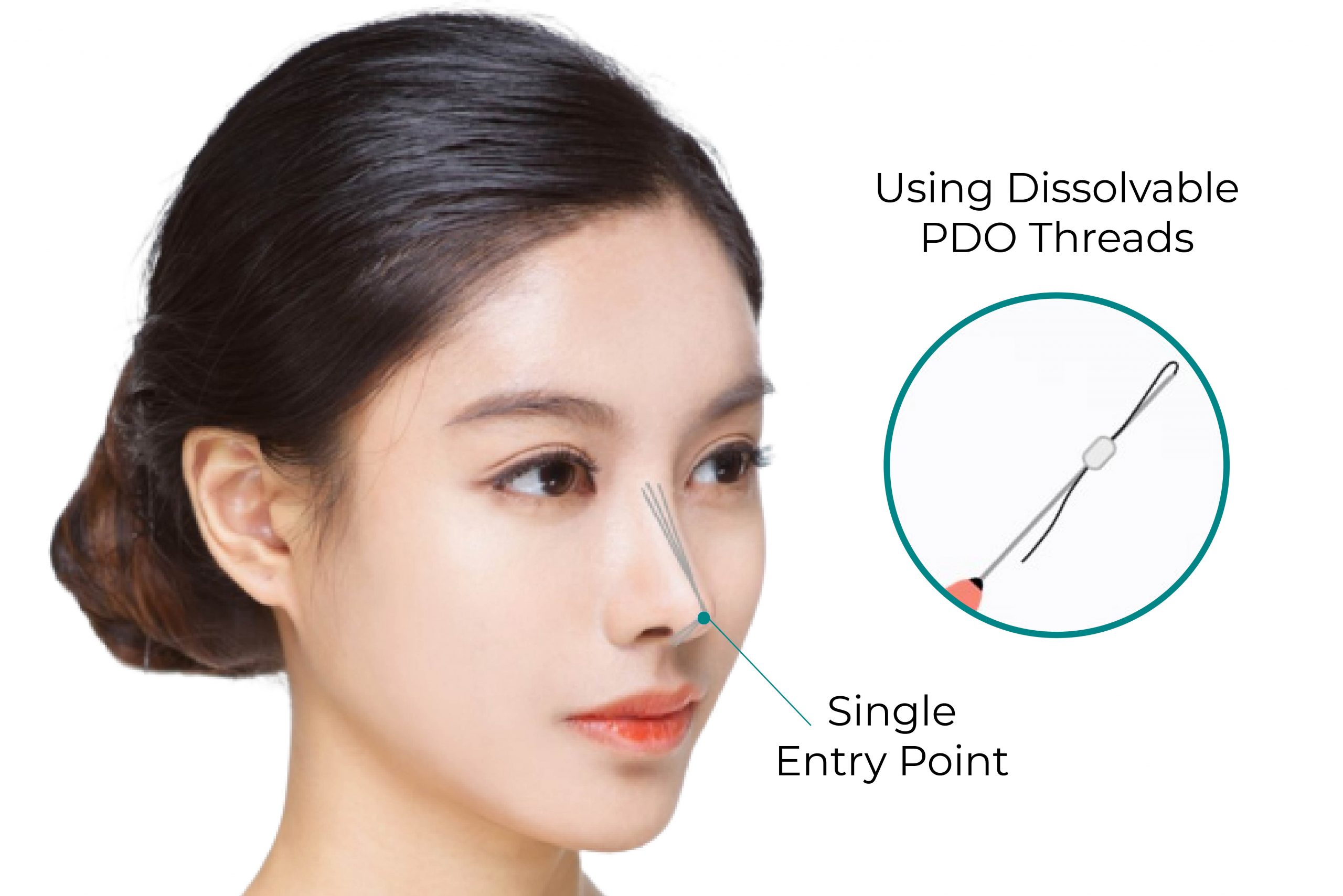 nose-thread-01-scaled.jpg nose-thread-01-scaled.jpg
