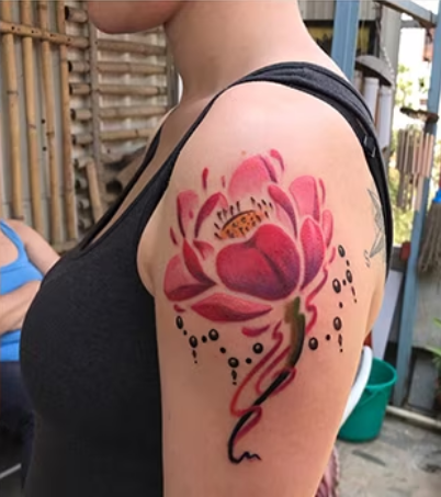 laser tattoo removal
