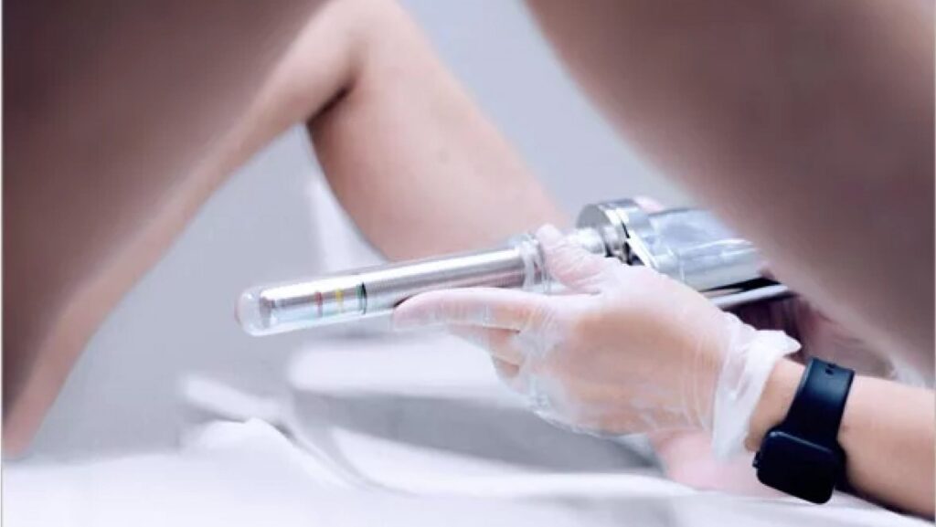 vaginal rejuvenation