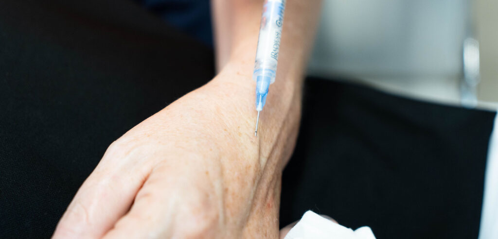 hand rejuvenation