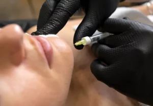 chin filler