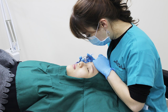 double eyelid suture