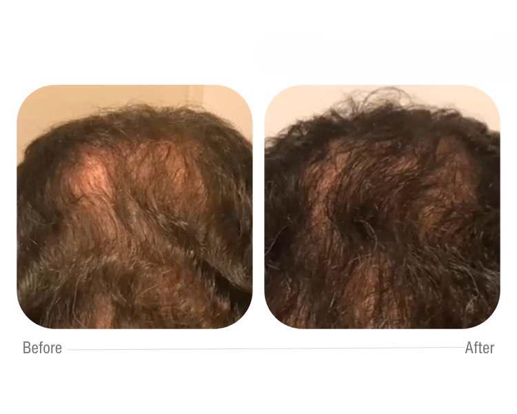cellbooster