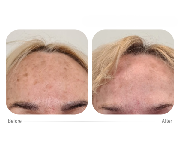 cellbooster