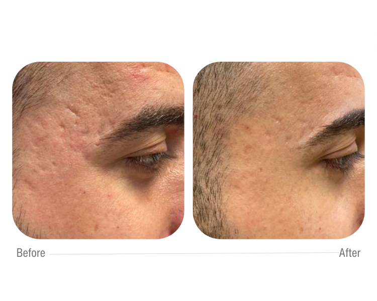 cellbooster