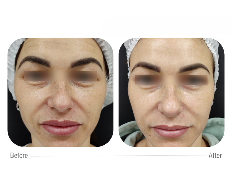 cellbooster