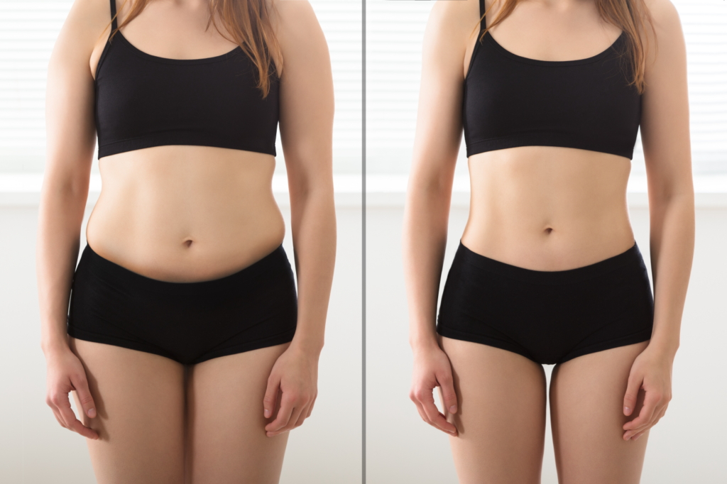 Mounjaro-Before-and-After-Weight
