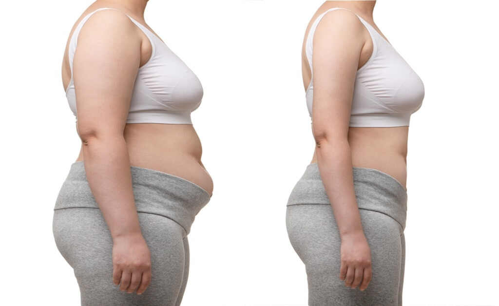 Mounjaro weight loss