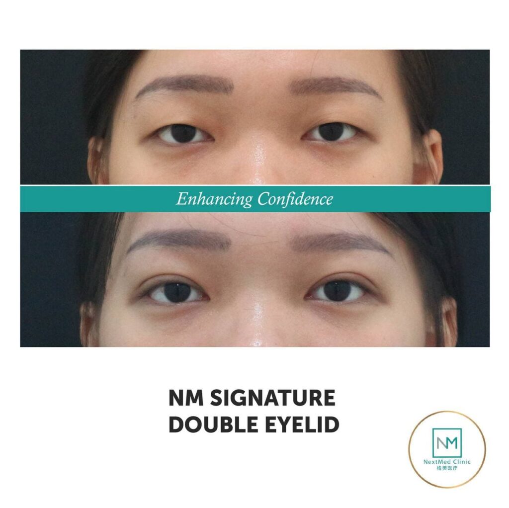 photo_2021-11-01_23-12-56