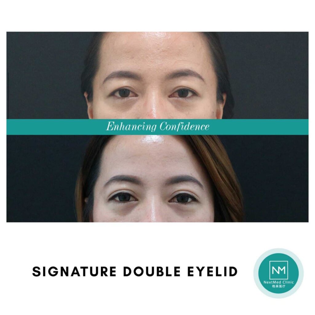 photo_2021-11-01_23-41-05