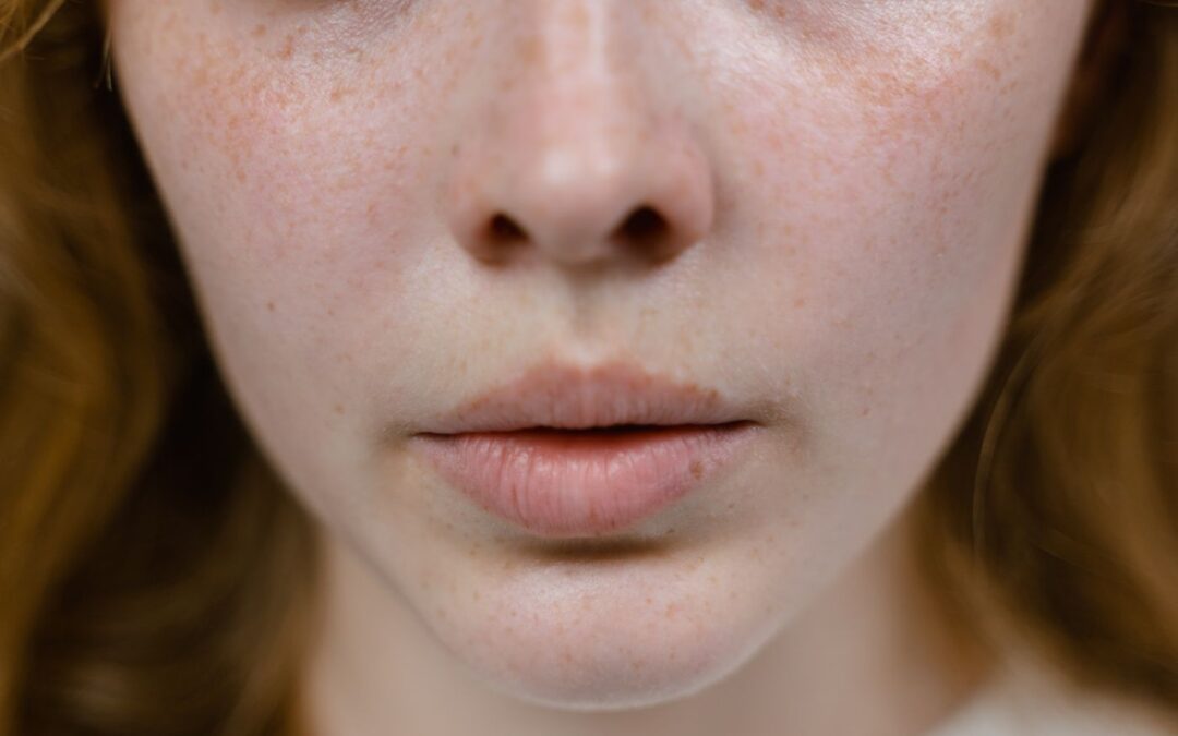 Lip Filler in Kuala Lumpur