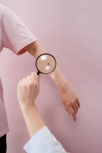 Magnifying glass held over a small brown spot on an arm